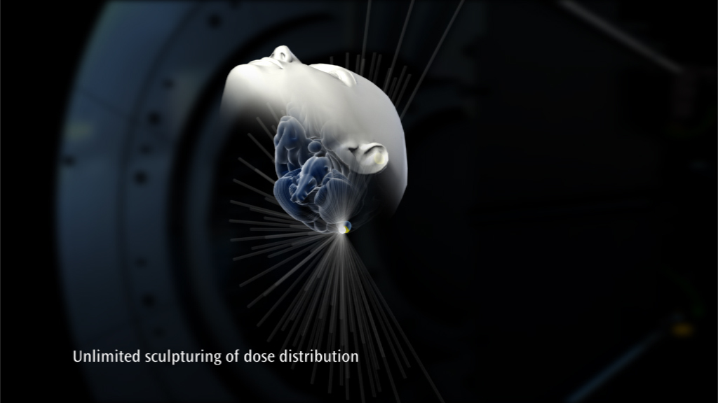 unlimited sculpturing of dose distribution